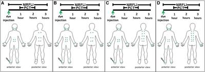 Case Report: The effect of automated manual lymphatic drainage therapy on lymphatic contractility in 4 distinct cases